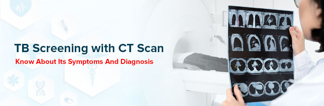 Know About Its Symptoms and Diagnosis of TB Screening With CT Scan